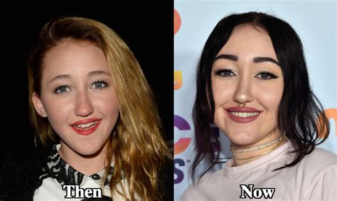 noah cyrus before after|Noah Cyrus: Before And After